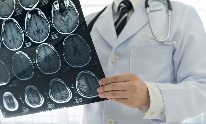Breakthrough in dementia research - uncovering early markers of prion disease in the eye