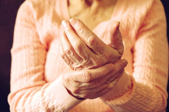 Participants needed for study of promising drug for hand osteoarthritis: Monash University 